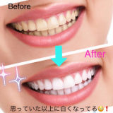 「驚きのセルフホワイトニング」の画像（2枚目）