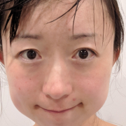 「鼻の下に大きなニキビができて困ってます」20名限定ブログ＆Instagramのお顔出しモニター大募集！ニキビケアに「ピュアクネスクリーム」の投稿画像