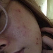 「肌荒れ、ほうれい線」＜商品PRモデルとして活躍！＞肌悩みのある方で撮影に参加頂ける方大募集！！の投稿画像