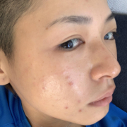 「すっぴんです」＜商品PRモデルとして活躍！＞肌悩みのある方で撮影に参加頂ける方大募集！！の投稿画像