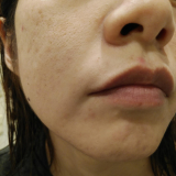 色ムラが少しずつ&hellip;