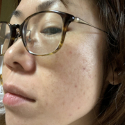 「毛穴ボコボコ」《20名募集》開き毛穴ケア用美容液リニューアルモニター（399）の投稿画像