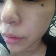 「【スッピン】開き毛穴がコンプレックス」《20名募集》開き毛穴ケア用美容液リニューアルモニター（399）の投稿画像
