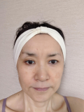 肌悩み
