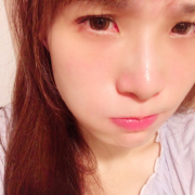 「顔出しＯＫです！」＜商品PRモデルとして活躍！＞肌悩みのある方で撮影に参加頂ける方大募集！！の投稿画像