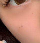 口コミ：顔に貼ってもバレない絆創膏！の画像（6枚目）