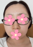「鼻の毛穴の開きが悩みです」の画像（1枚目）