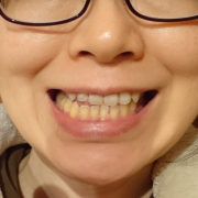 「お願いします」【薬用美白】歯磨きジェル☆ビフォーアフター投稿モニター20名様　募集！の投稿画像