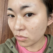 「私」「シワ改善」無添加【薬用】オールインワンゲル☆ビフォーアフター投稿モニター20名様　募集！の投稿画像