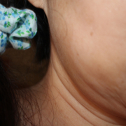 「首やほうれい線」「シワ改善」無添加【薬用】オールインワンゲル☆ビフォーアフター投稿モニター20名様　募集！の投稿画像