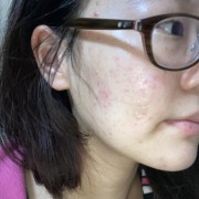 「悩み」「シワ改善」無添加【薬用】オールインワンゲル☆ビフォーアフター投稿モニター20名様　募集！の投稿画像