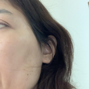 「頬のシミ」「シワ改善」無添加【薬用】オールインワンゲル☆ビフォーアフター投稿モニター20名様　募集！の投稿画像