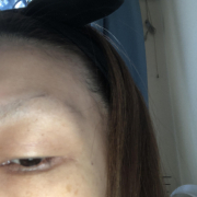 「目元のシミが気になる！！」「シワ改善」無添加【薬用】オールインワンゲル☆ビフォーアフター投稿モニター20名様　募集！の投稿画像