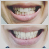 上かbefore、下がafter