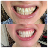 「意外と変化ありました！！！」の画像（1枚目）