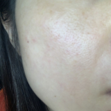 毛穴が気になる！