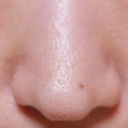 「鼻まわり」★無添加ミネラルリキッドファンデ★を使って艶肌に♪画像投稿モニター募集！の投稿画像