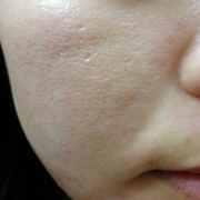 「毛穴が目立ってしまう」★無添加ミネラルリキッドファンデ★を使って艶肌に♪画像投稿モニター募集！の投稿画像