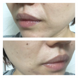 「使用から約1ヶ月」の画像（1枚目）