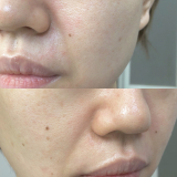 「使用から約1ヶ月」の画像（2枚目）