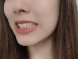 「磨くとツルツルになりました！」の画像（1枚目）