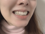「磨くとツルツルになりました！」の画像（2枚目）