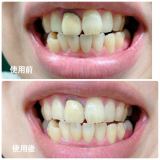 「前後」の画像（1枚目）