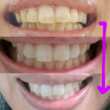 「歯の写真」の画像（1枚目）