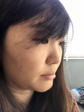 頬の高い所