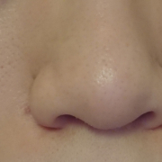 「わたしの悩みの「シミ」「黒ずみ」はコレ！」★画像投稿★お顔の気になる「シミ」「黒ずみ」に！ピンポイント美白パックを使って景品をゲット～！の投稿画像