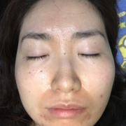 「気になる」★画像投稿★お顔の気になる「シミ」「黒ずみ」に！ピンポイント美白パックを使って景品をゲット～！の投稿画像