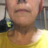 「67歳です」の画像（1枚目）