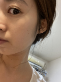 「シワの改善」の画像（1枚目）