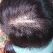 「つむじが気になる」★新商品モニター★白髪・薄毛を隠せるヘアファンデーション使って画像投稿～の投稿画像