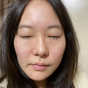 「肌悩み」★新商品モニター★ファンデ級カバー力の薬用美白美容液を使って画像投稿～の投稿画像