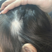 「お恥ずかしいのですが」★新商品モニター★白髪・薄毛を隠せるヘアファンデーション使って画像投稿～の投稿画像