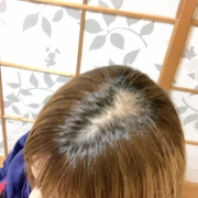 「トップ」★新商品モニター★白髪・薄毛を隠せるヘアファンデーション使って画像投稿～の投稿画像