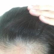 「生え際の白髪」★新商品モニター★白髪・薄毛を隠せるヘアファンデーション使って画像投稿～の投稿画像