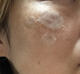 集中美白パック（ピールオフタイプ）