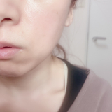 「毛穴ふっくら」の画像（1枚目）