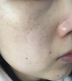 「毛穴を小さくしてくすみが取れる美容液」の画像（2枚目）