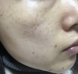 「毛穴を小さくしてくすみが取れる美容液」の画像（1枚目）