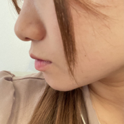 「鼻、頬の毛穴を引き締めたい！」《5名募集》ソワン美容液リニューアルモニター（408）の投稿画像