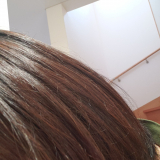 口コミ：&rdquo;コラゲネイド　２ヶ月後&rdquo;の画像（4枚目）