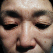 「見るも無残な開き具合」《5名募集》ソワン美容液リニューアルモニター（408）の投稿画像