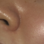 「毛穴」《5名募集》ソワン美容液リニューアルモニター（408）の投稿画像