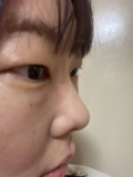 「2ヶ月使用経過」の画像（2枚目）
