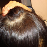 白髪・薄毛を隠せるヘアファンデーション使用前です