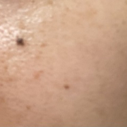 「しみ、そばかす」「シワ改善」無添加【薬用】オールインワンゲル☆ビフォーアフター投稿モニター30名様　募集！の投稿画像