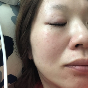 「よろしくお願いします。」「シワ改善」無添加【薬用】オールインワンゲル☆ビフォーアフター投稿モニター30名様　募集！の投稿画像